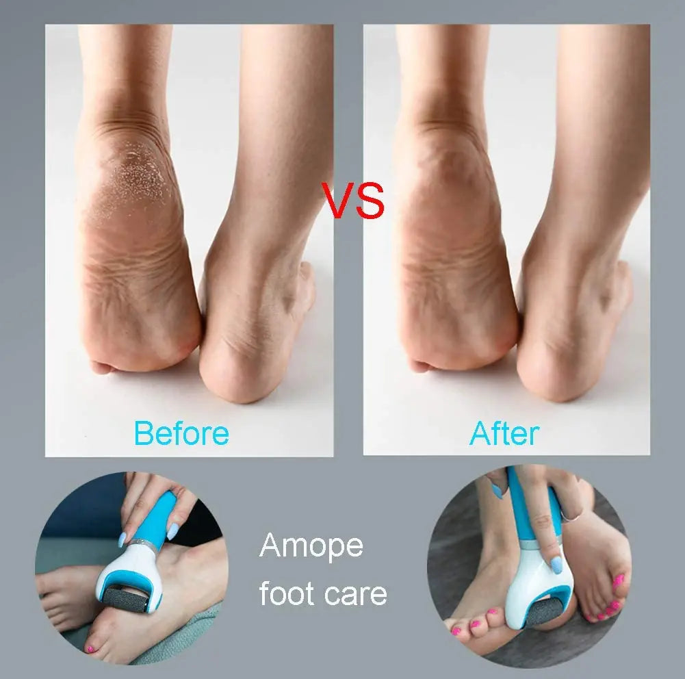 Electric Foot File Dead Skin Remover