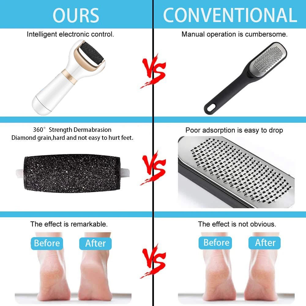 Electric Foot File Dead Skin Remover